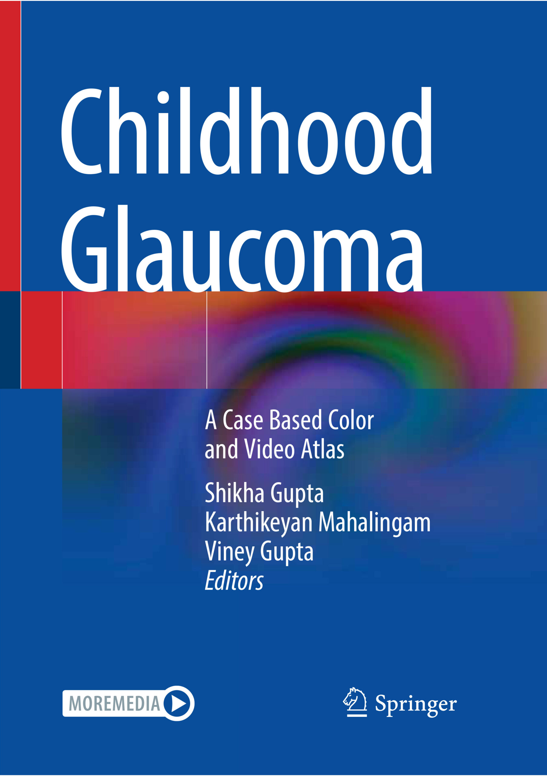 Childhood Glaucoma