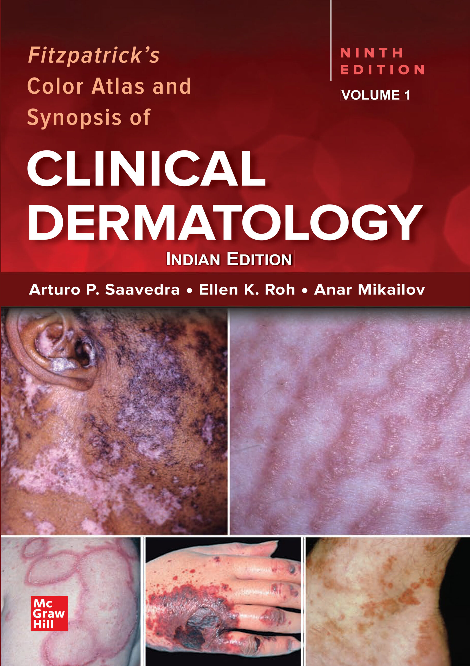 Clinical Dermatology